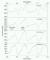 Pp vela ao4.gif